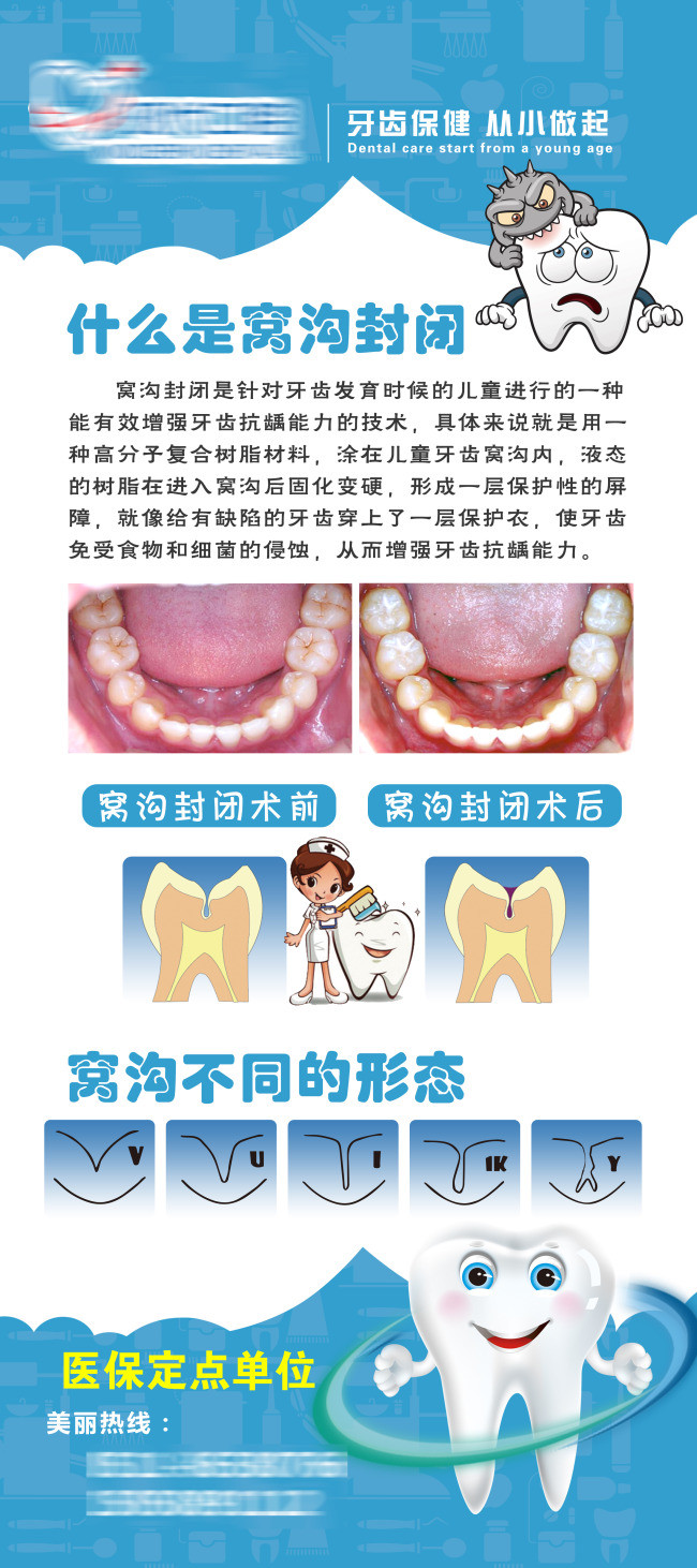 牙科展架图
