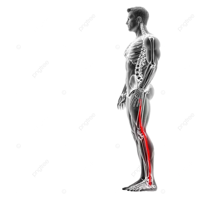 男性坐骨神经痛的解剖 X 射线视图